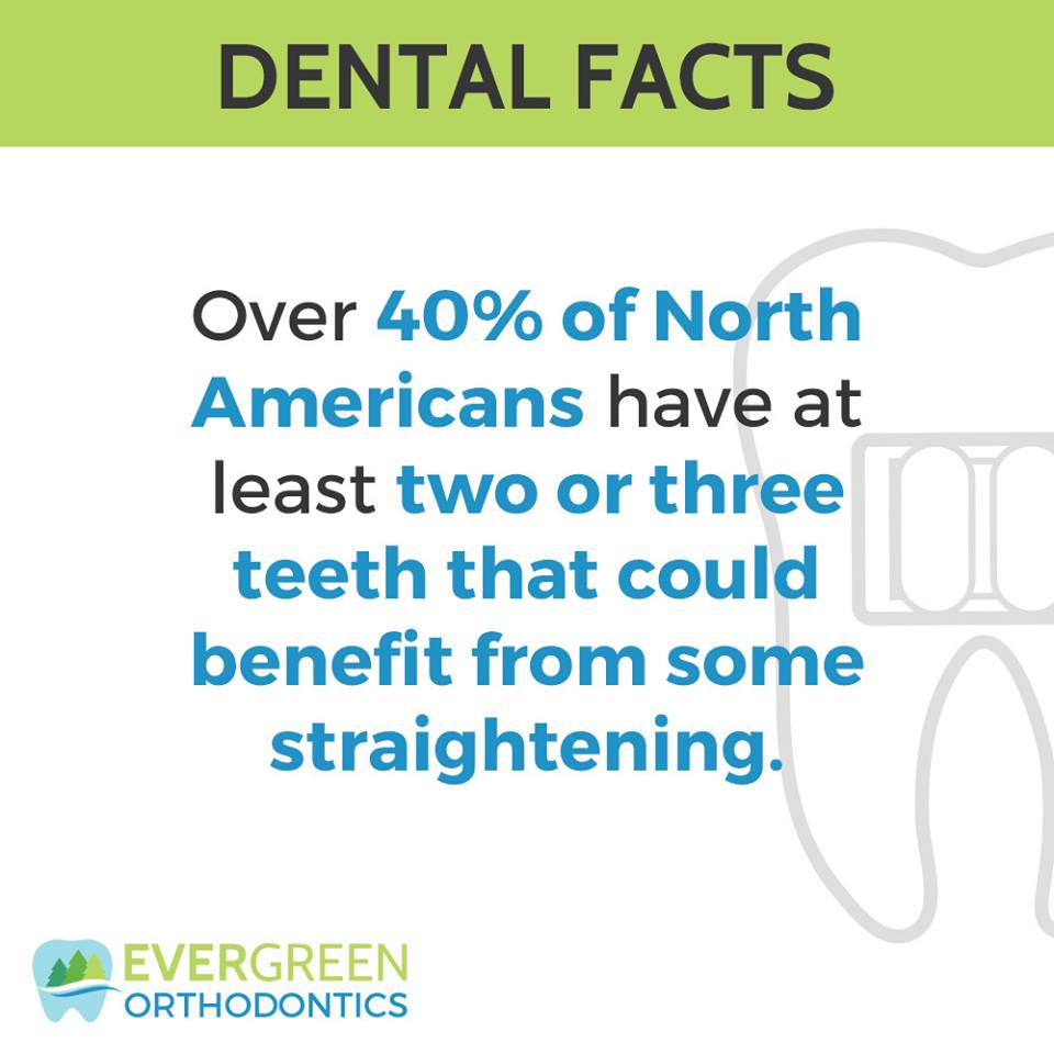 dental-facts-teeth-straightening