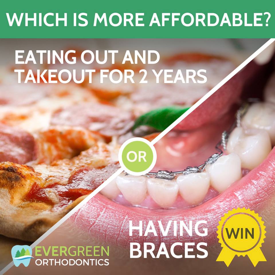 how-affordable-are-braces-vs-food