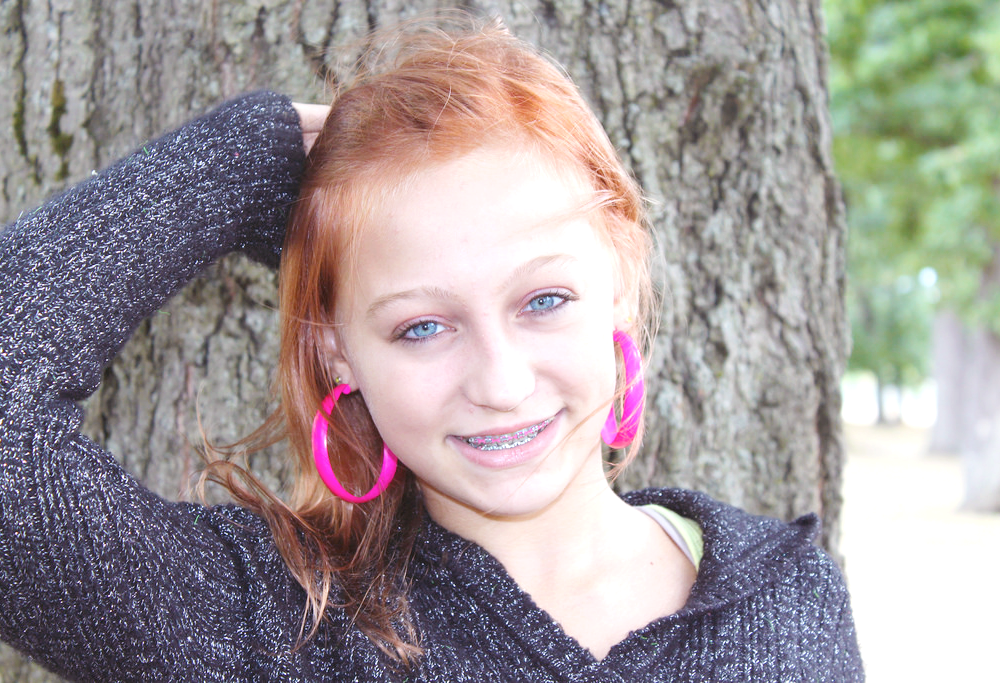 Teenage Girl Braces Coquitlam Orthodontics Clinic.